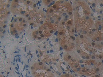 GSTT2 Antibody in Immunohistochemistry (Paraffin) (IHC (P))