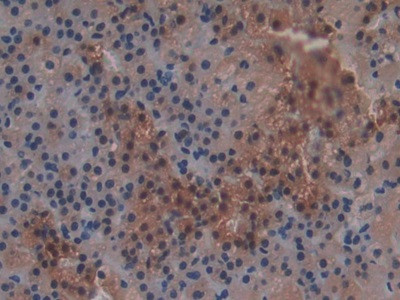 GSTT2 Antibody in Immunohistochemistry (Paraffin) (IHC (P))