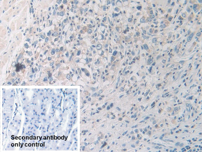PYGB Antibody in Immunohistochemistry (Paraffin) (IHC (P))