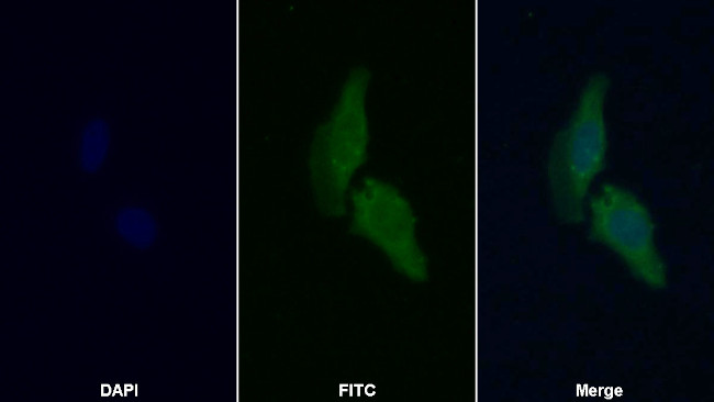 PYGM Antibody in Immunocytochemistry (ICC/IF)