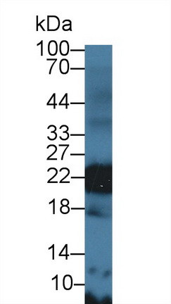 CD42a Antibody in Western Blot (WB)