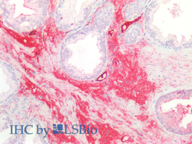 C1orf85 Antibody in Immunohistochemistry (Paraffin) (IHC (P))