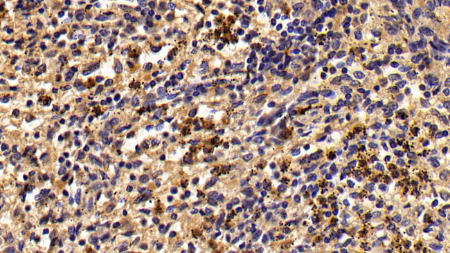 Granzyme M Antibody in Immunohistochemistry (Paraffin) (IHC (P))
