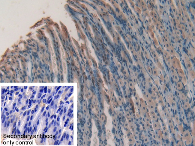 GREM1 Antibody in Immunohistochemistry (Paraffin) (IHC (P))