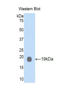 GDF1 Antibody in Western Blot (WB)