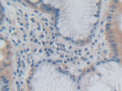 GH2 Antibody in Immunohistochemistry (Paraffin) (IHC (P))