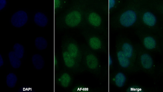 GDA Antibody in Immunocytochemistry (ICC/IF)