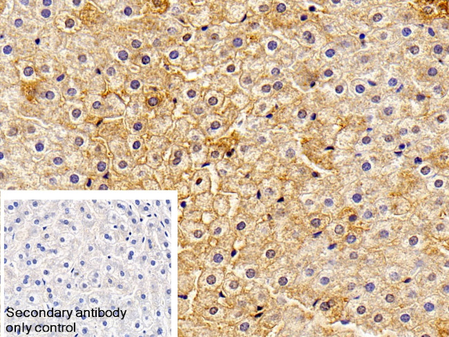 Haptoglobin Antibody in Immunohistochemistry (Paraffin) (IHC (P))