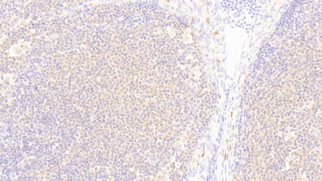 DNAJC4 Antibody in Immunohistochemistry (Paraffin) (IHC (P))