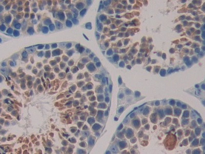 HSP40 Antibody in Immunohistochemistry (Paraffin) (IHC (P))