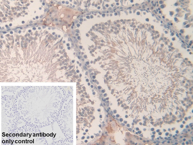 Hemoglobin alpha-1 Antibody in Immunohistochemistry (Paraffin) (IHC (P))