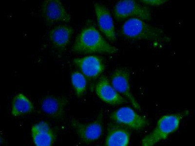 HBD Antibody in Immunocytochemistry (ICC/IF)