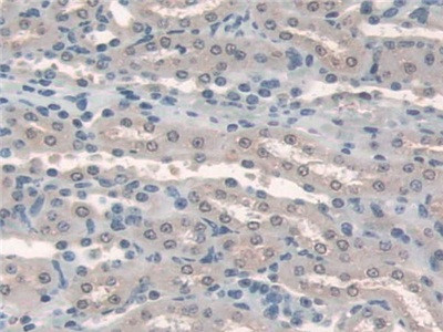 HPS4 Antibody in Immunohistochemistry (Paraffin) (IHC (P))