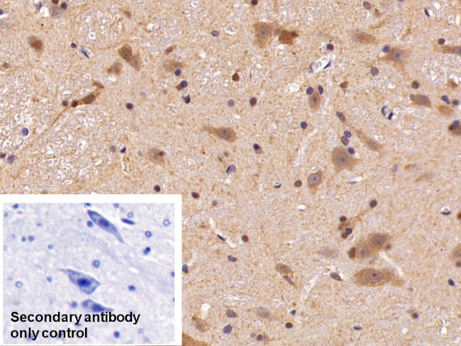 HMGB1 Antibody in Immunohistochemistry (Paraffin) (IHC (P))