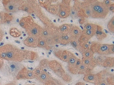 HDC Antibody in Immunohistochemistry (Paraffin) (IHC (P))