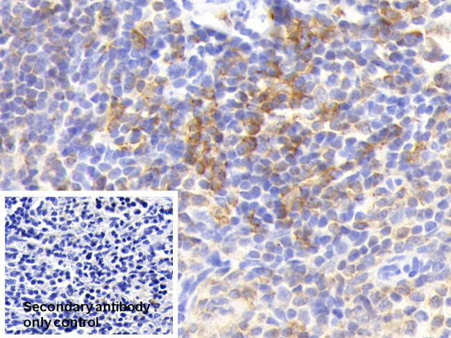 HLA-DRA Antibody in Immunohistochemistry (Paraffin) (IHC (P))