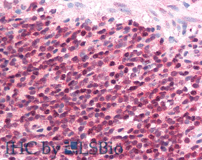 CD275 (B7-H2) Antibody in Immunohistochemistry (Paraffin) (IHC (P))