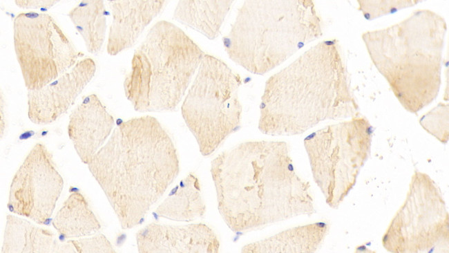 INHBE Antibody in Immunohistochemistry (Paraffin) (IHC (P))