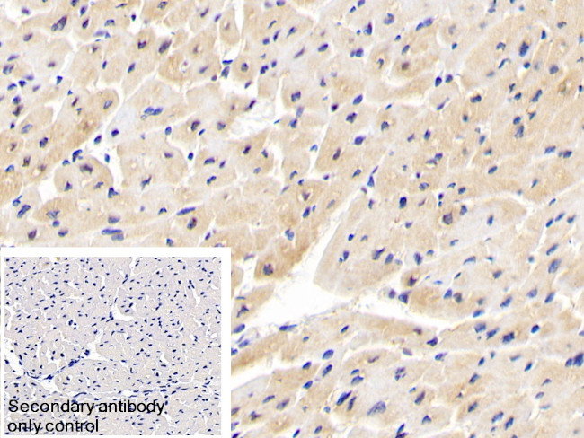 INPP4A Antibody in Immunohistochemistry (Paraffin) (IHC (P))