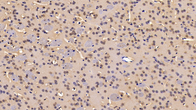 IDE Antibody in Immunohistochemistry (Paraffin) (IHC (P))