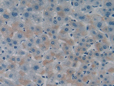 ITFG1 Antibody in Immunohistochemistry (Paraffin) (IHC (P))