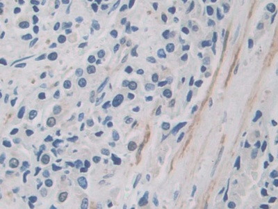 ITIH1 Antibody in Immunohistochemistry (Paraffin) (IHC (P))