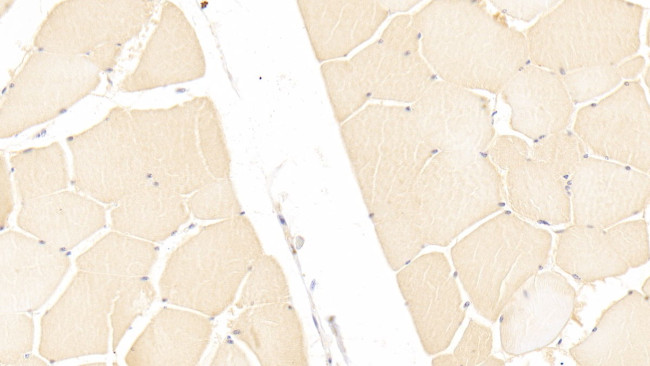 ITIH3 Antibody in Immunohistochemistry (Paraffin) (IHC (P))