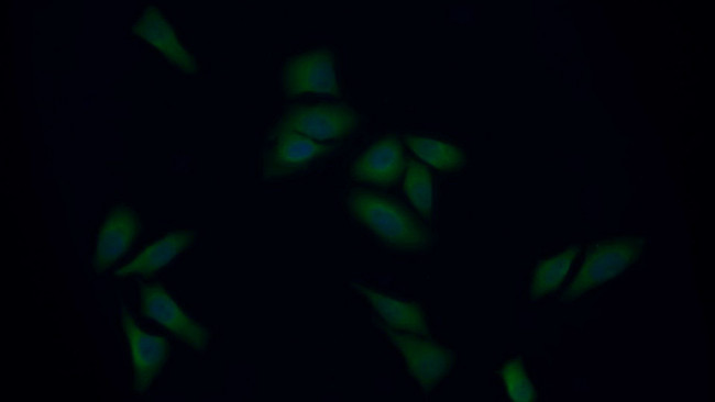 IFNAR2 Antibody in Immunocytochemistry (ICC/IF)