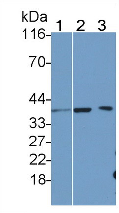 IL-1 beta Antibody in Western Blot (WB)