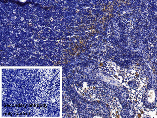 IL-1RAcP Antibody in Immunohistochemistry (Paraffin) (IHC (P))