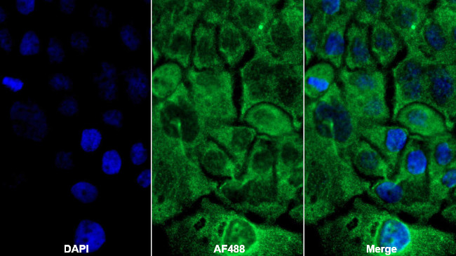 IL1R1 Antibody in Immunocytochemistry (ICC/IF)