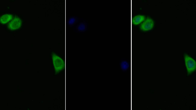 IL11RA Antibody in Immunocytochemistry (ICC/IF)