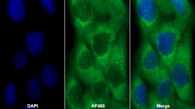 IDH1 Antibody in Immunocytochemistry (ICC/IF)