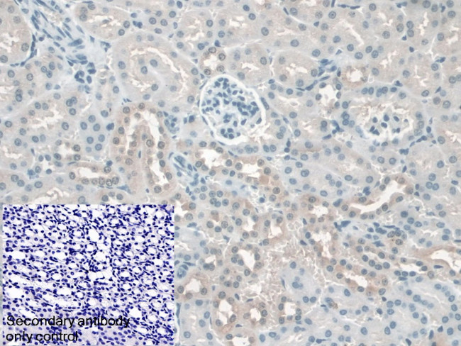 KATNA1 Antibody in Immunohistochemistry (Paraffin) (IHC (P))