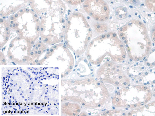 KATNA1 Antibody in Immunohistochemistry (Paraffin) (IHC (P))
