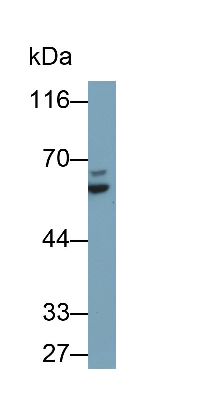 Cytokeratin 2e Antibody in Western Blot (WB)