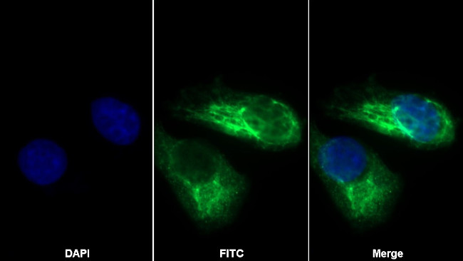 KRT33A Antibody in Immunocytochemistry (ICC/IF)