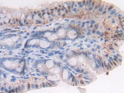 LTBP1 Antibody in Immunohistochemistry (Paraffin) (IHC (P))