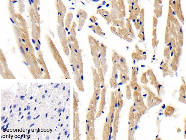 LEPR Antibody in Immunohistochemistry (Paraffin) (IHC (P))
