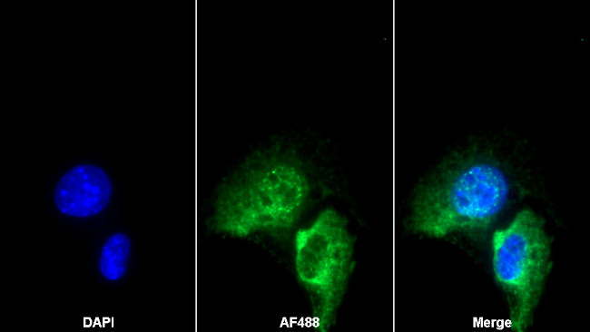 GARP Antibody in Immunocytochemistry (ICC/IF)