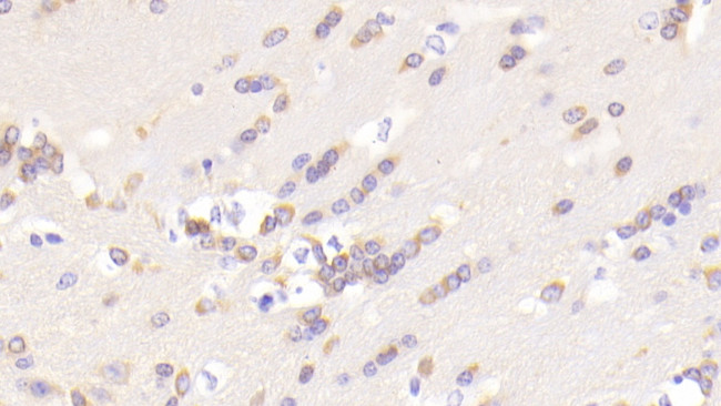 PIDD Antibody in Immunohistochemistry (Paraffin) (IHC (P))
