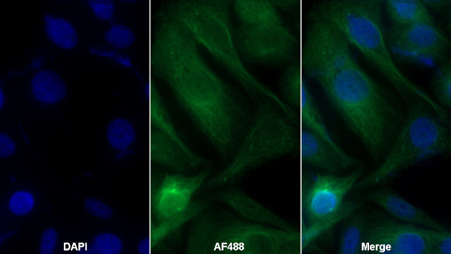 LTBR Antibody in Immunocytochemistry (ICC/IF)