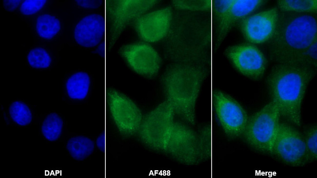 MMP13 Antibody in Immunocytochemistry (ICC/IF)