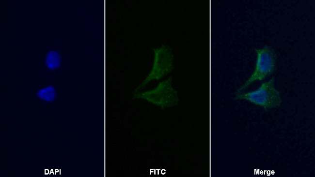 MMP9 Antibody in Immunocytochemistry (ICC/IF)