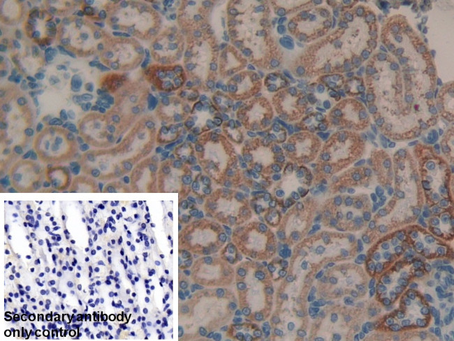 MMP9 Antibody in Immunohistochemistry (Paraffin) (IHC (P))