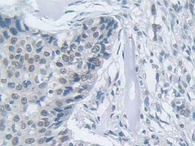 MPP5 Antibody in Immunohistochemistry (Paraffin) (IHC (P))