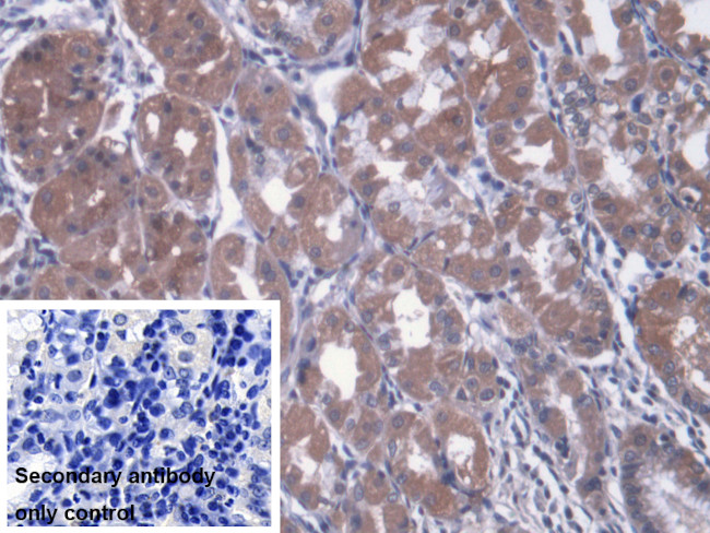 MTX1 Antibody in Immunohistochemistry (Paraffin) (IHC (P))