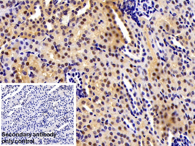 MAT2A Antibody in Immunohistochemistry (Paraffin) (IHC (P))