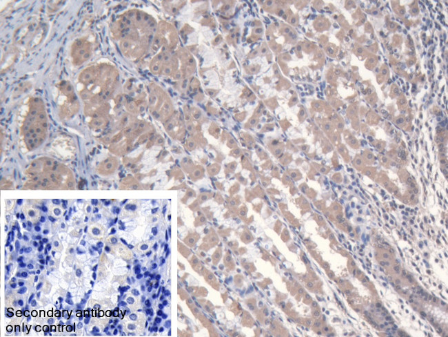 MARS Antibody in Immunohistochemistry (Paraffin) (IHC (P))