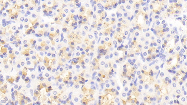 MIB2 Antibody in Immunohistochemistry (Paraffin) (IHC (P))